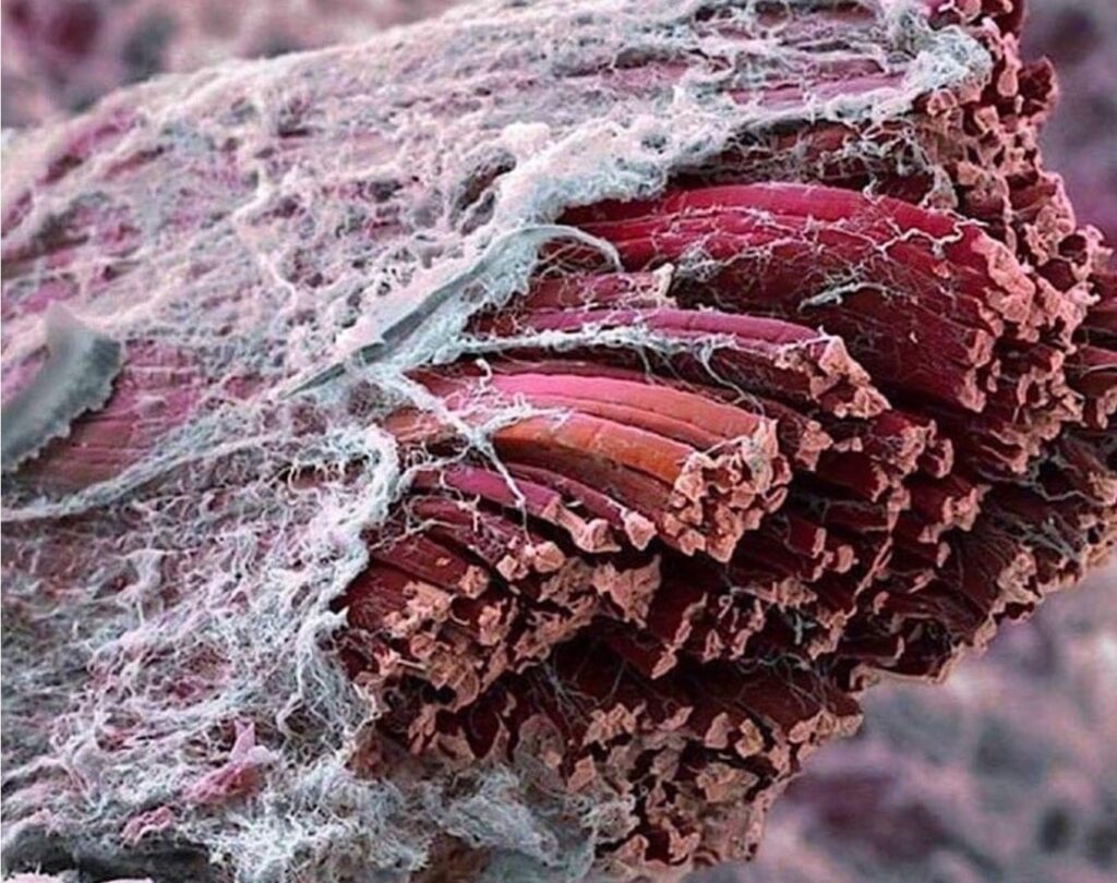 myofascia