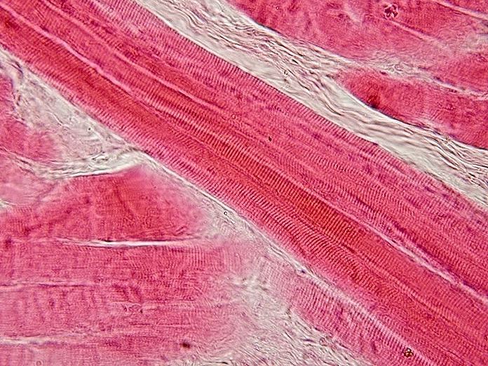 Skeletal_muscle_-_longitudinal_section
