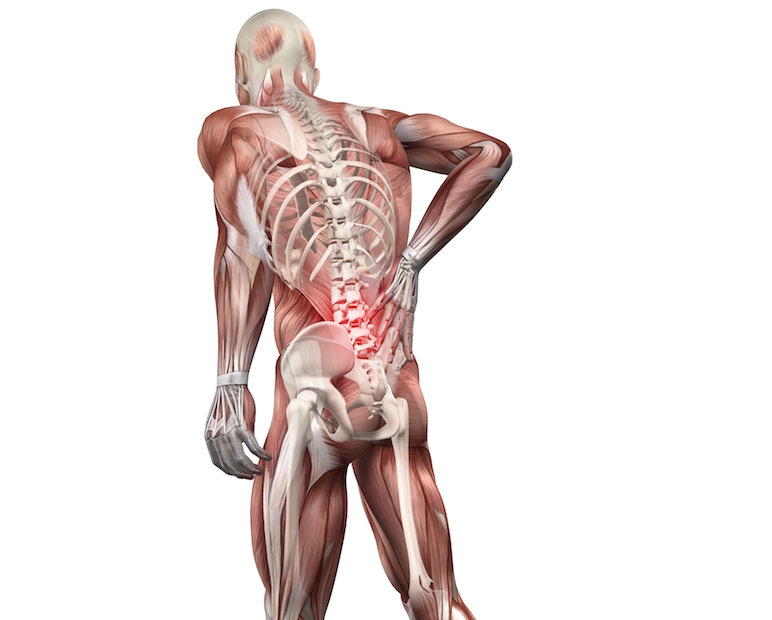 low back pain