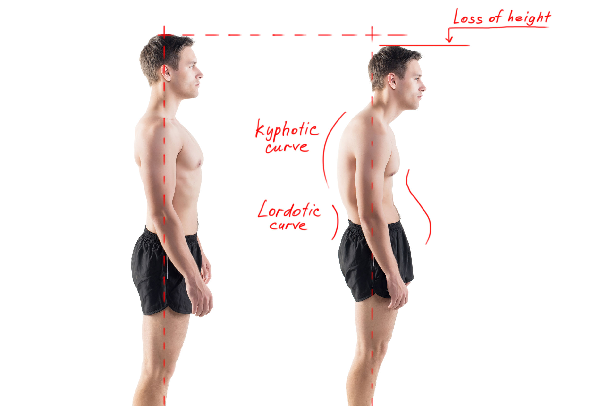good posture tips