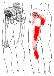 pain patterns
