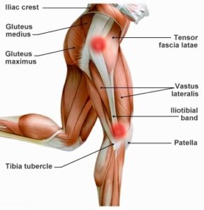 iliotibial band in runners knee